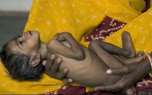 Malnutrition in Odisha