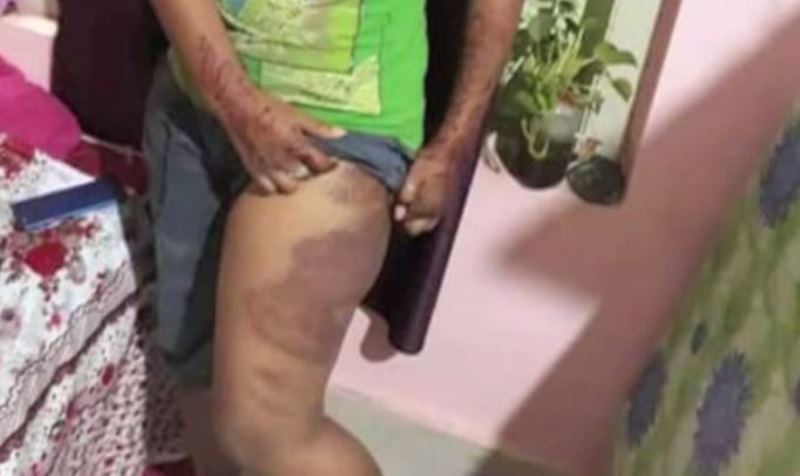 Girls allegedly beaten-up by Odisha cops
