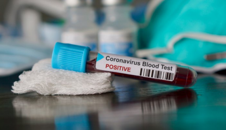 coronavirus uk update