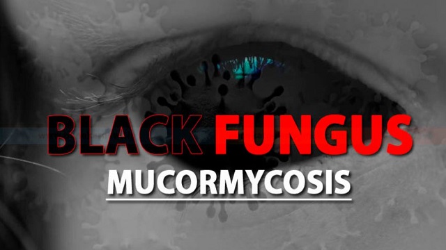 Maharashtra caps cost of black fungus treatment