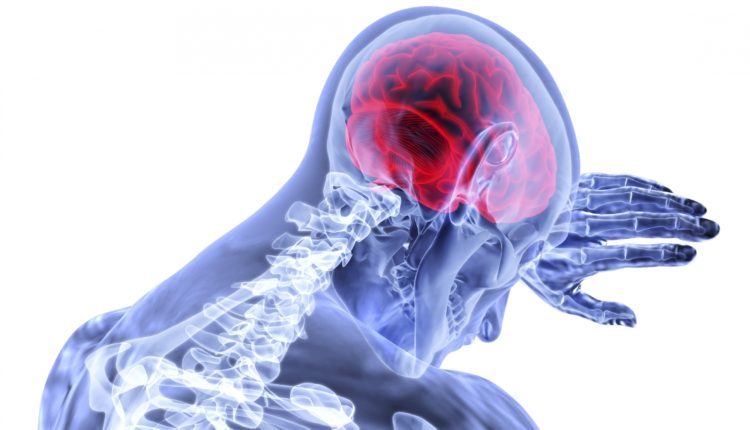 lifestyle to reduce brain stroke