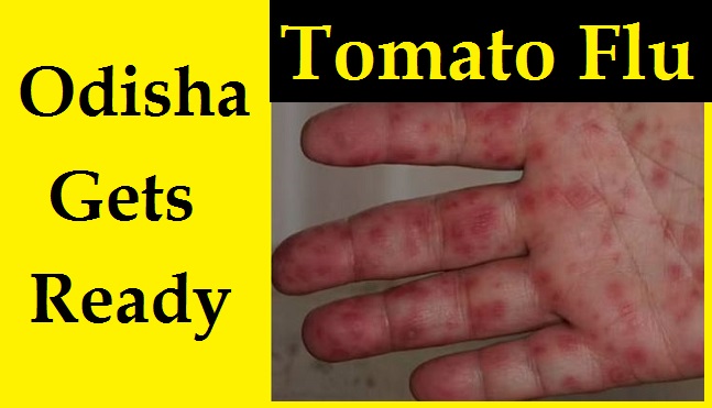 Tomato Flu In Odisha