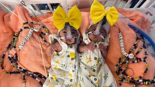 Identical twins born 3 days apart