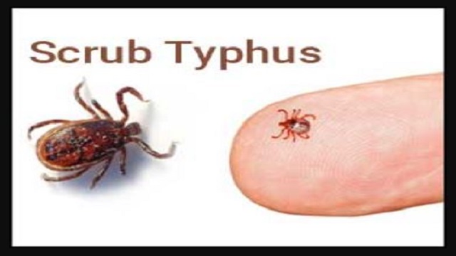 Scrub typhus cases