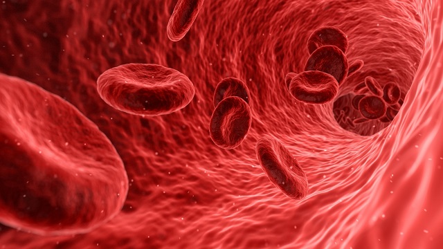 New tool predicts blood clots in brain