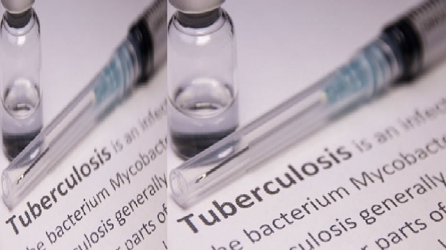 female genital tuberculosis