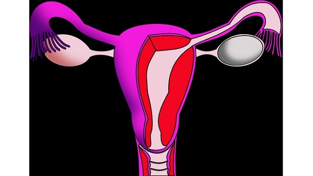 Endometriosis signs and symptoms