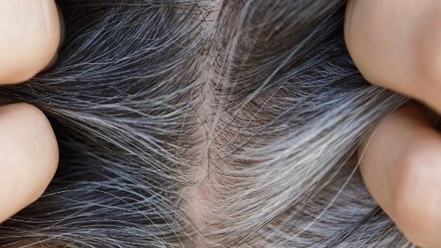 why does hair turn grey