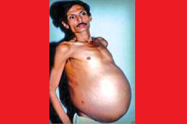pregnant like look Nagpur man