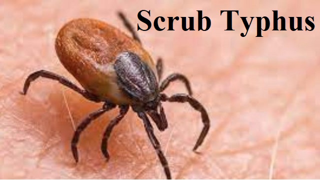 scrub typhus in sundergarh