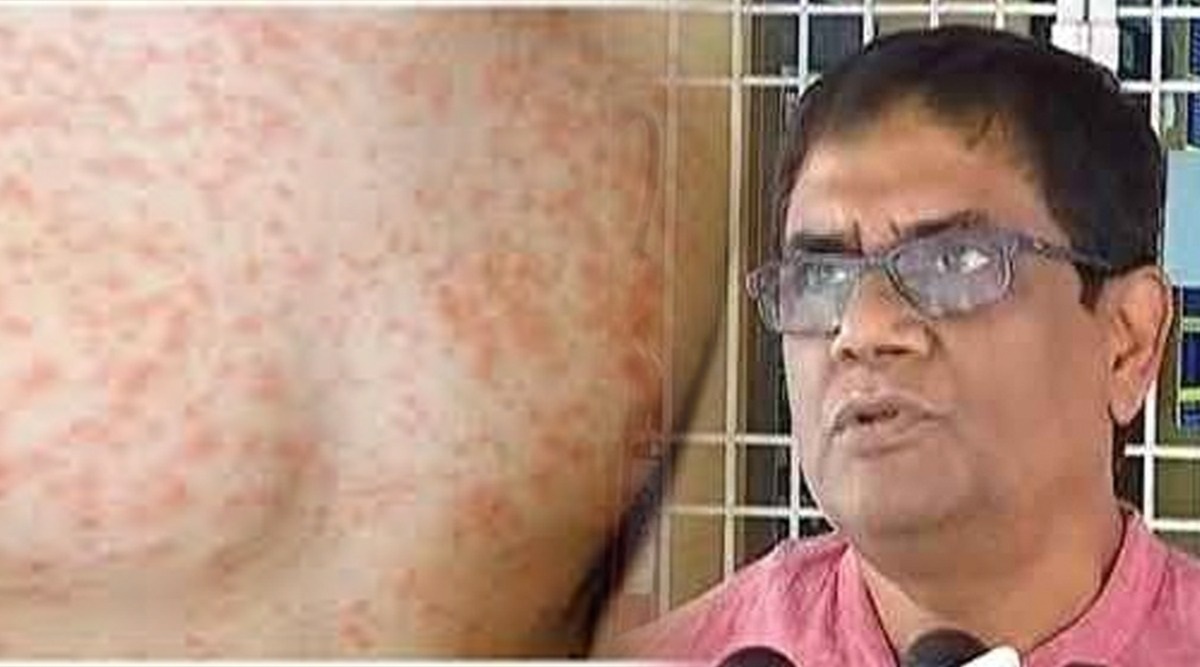 rubella infection in odisha